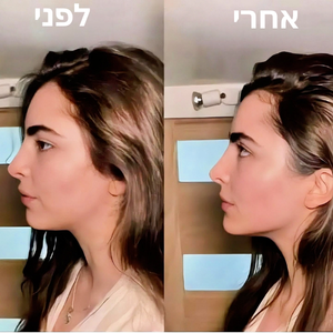 מברשת לניקוז הפנים